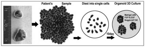 A method for culturing lung and lung cancer tissue and a method for constructing a mouse animal model of lung cancer using the same