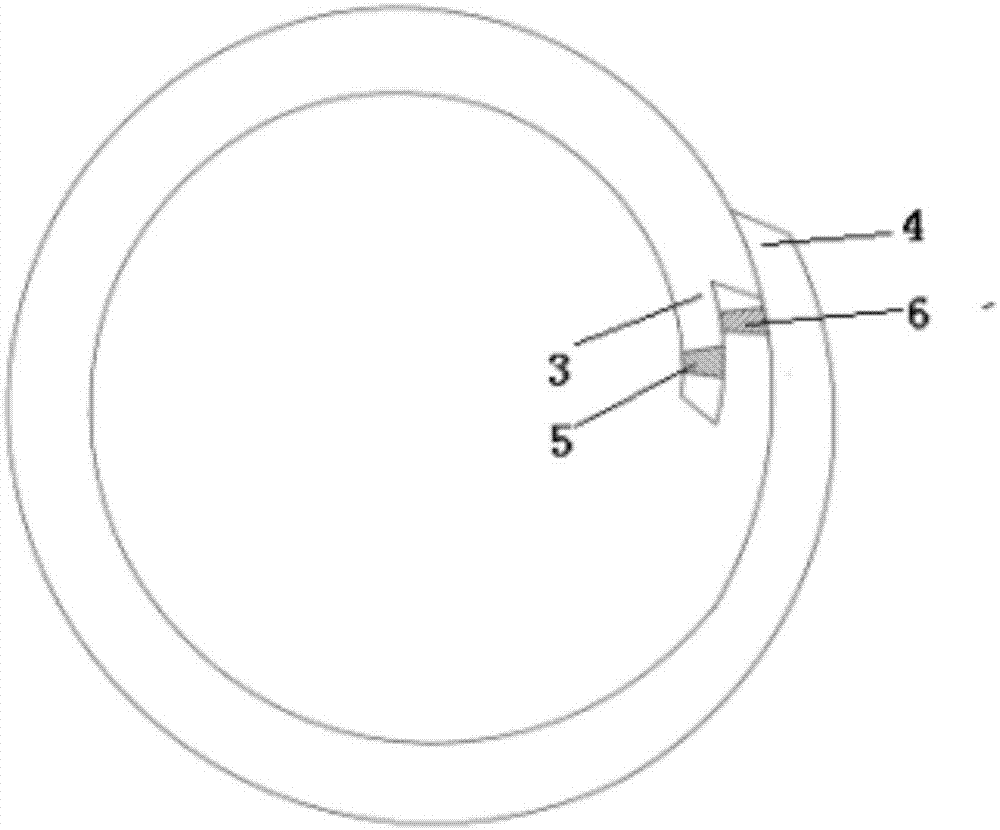 Intravascular stent in type of supporting rib having mortise and tenon joint structure