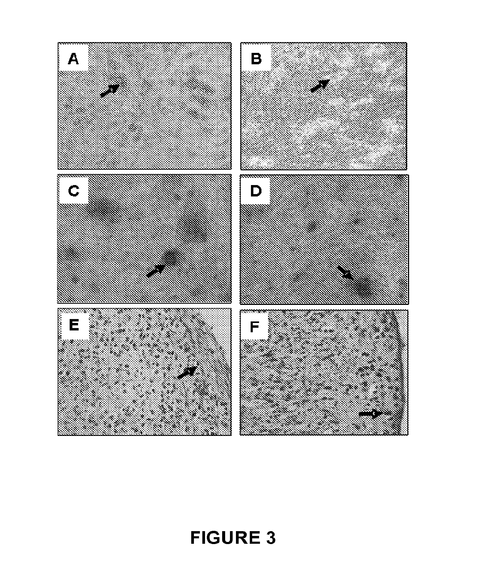 Monoclonal antibody stro-4