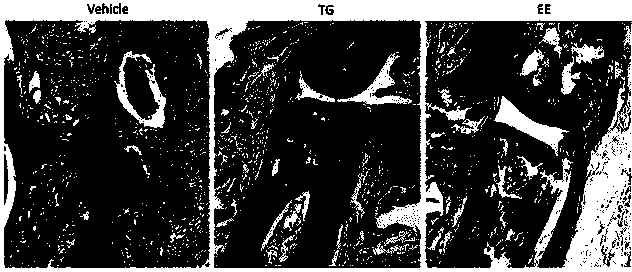 Application of eleutheroside E in preparation of rheumatoid arthritis treating medicine