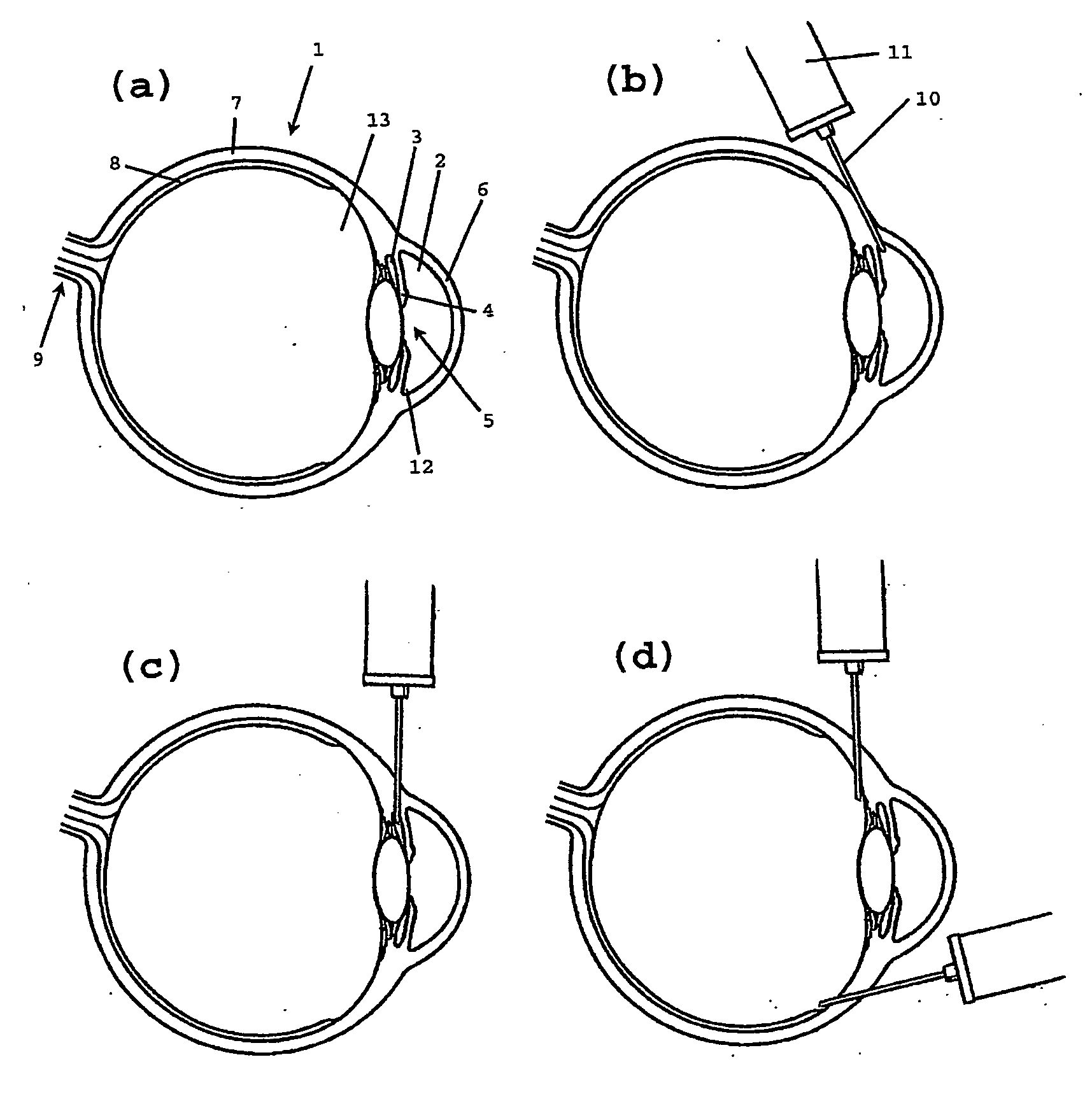 Use Of A Viscoelastic Composition For Treating Increased Intraocular Pressure