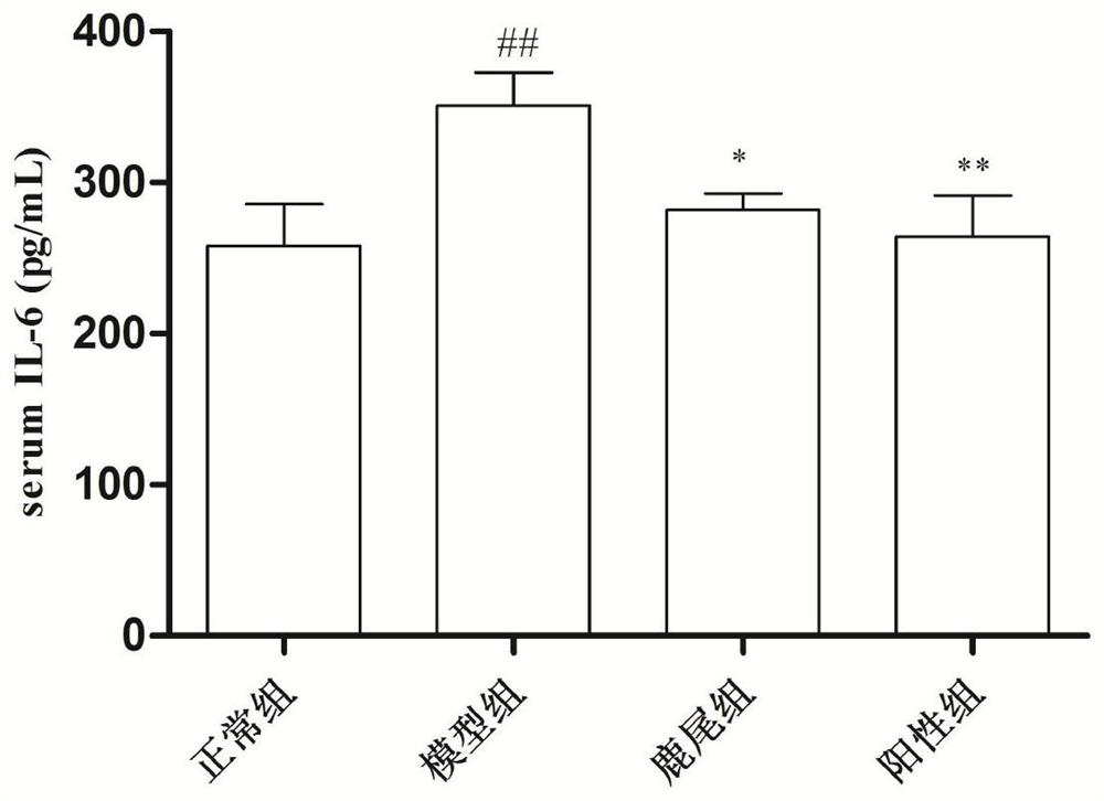 Application of deer tail in preparation of products for treating gout and hyperuricemia