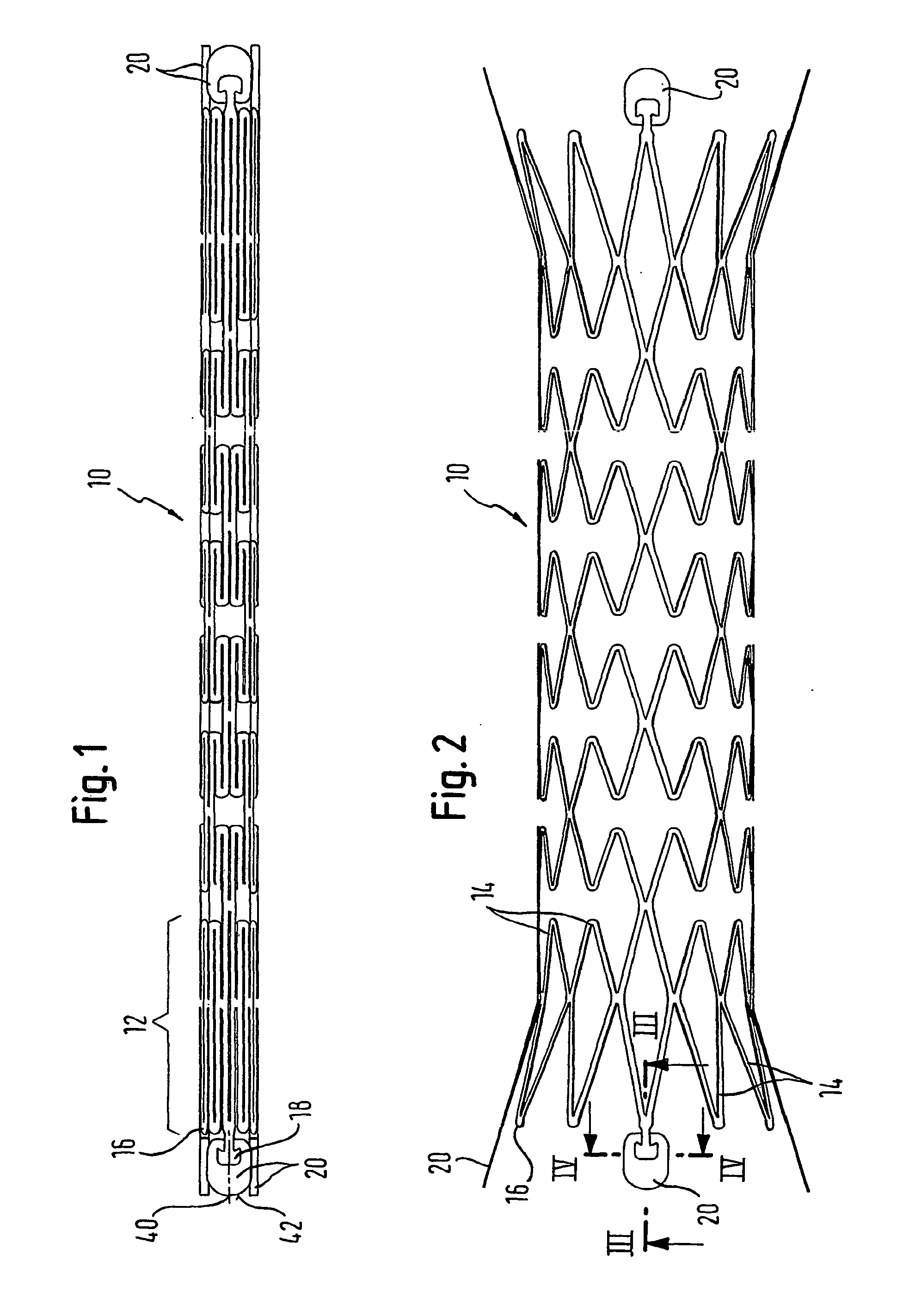 Implant with attached element and method of making such an implant