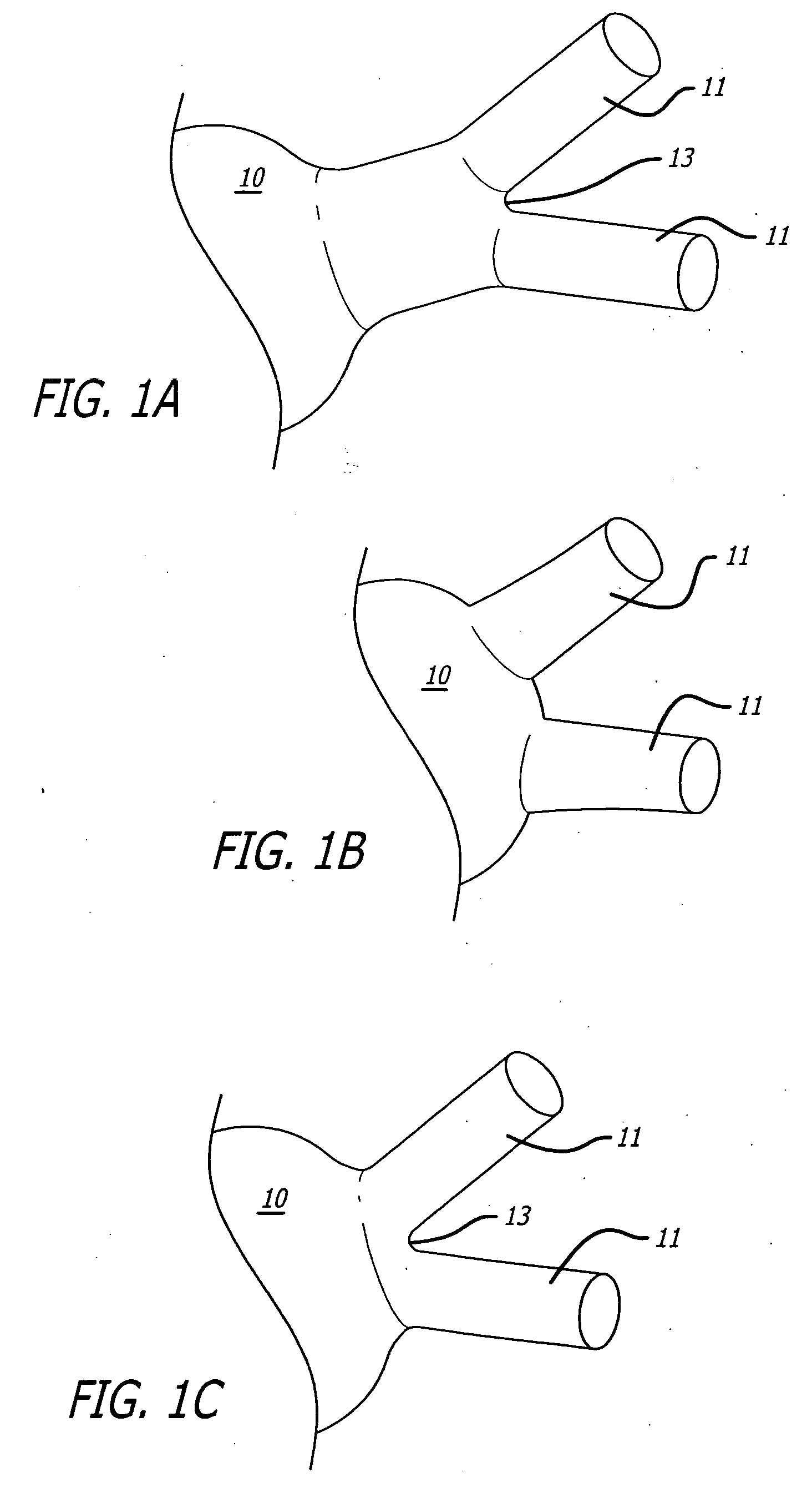 Electrical conduction block implant device