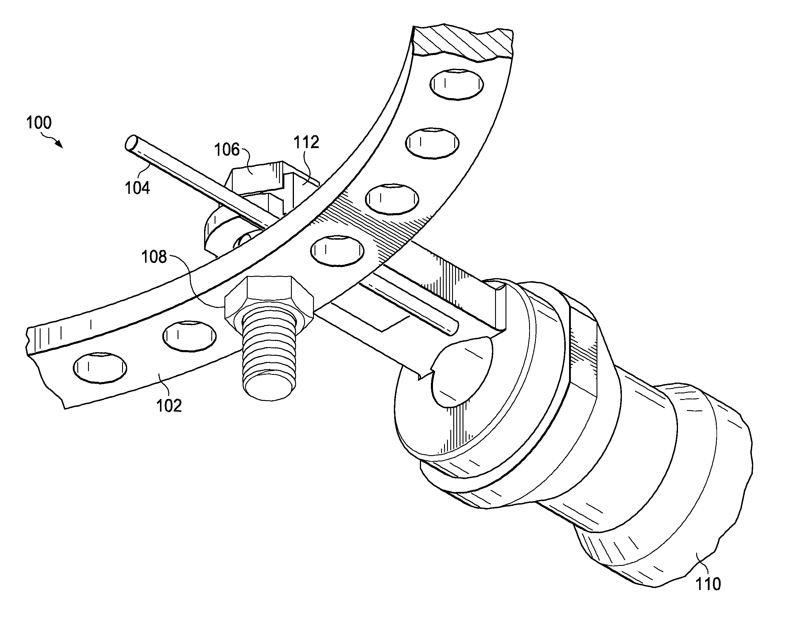 Wire tensioner tip for use with wire fixation bolt