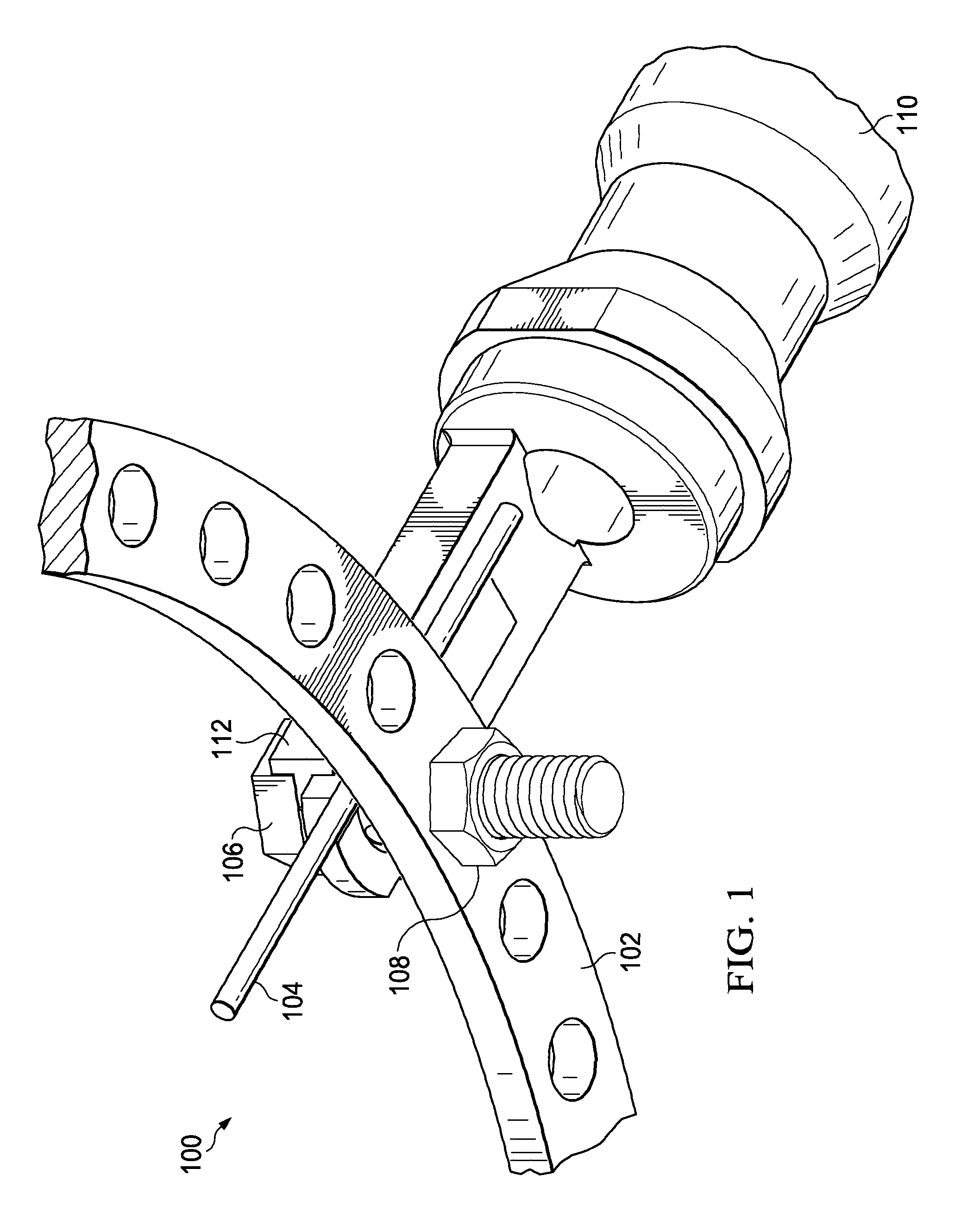 Wire tensioner tip for use with wire fixation bolt