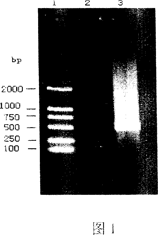 Application process of pig interleukin 2 and 6 gene expression plasmid anti-infectious preparation