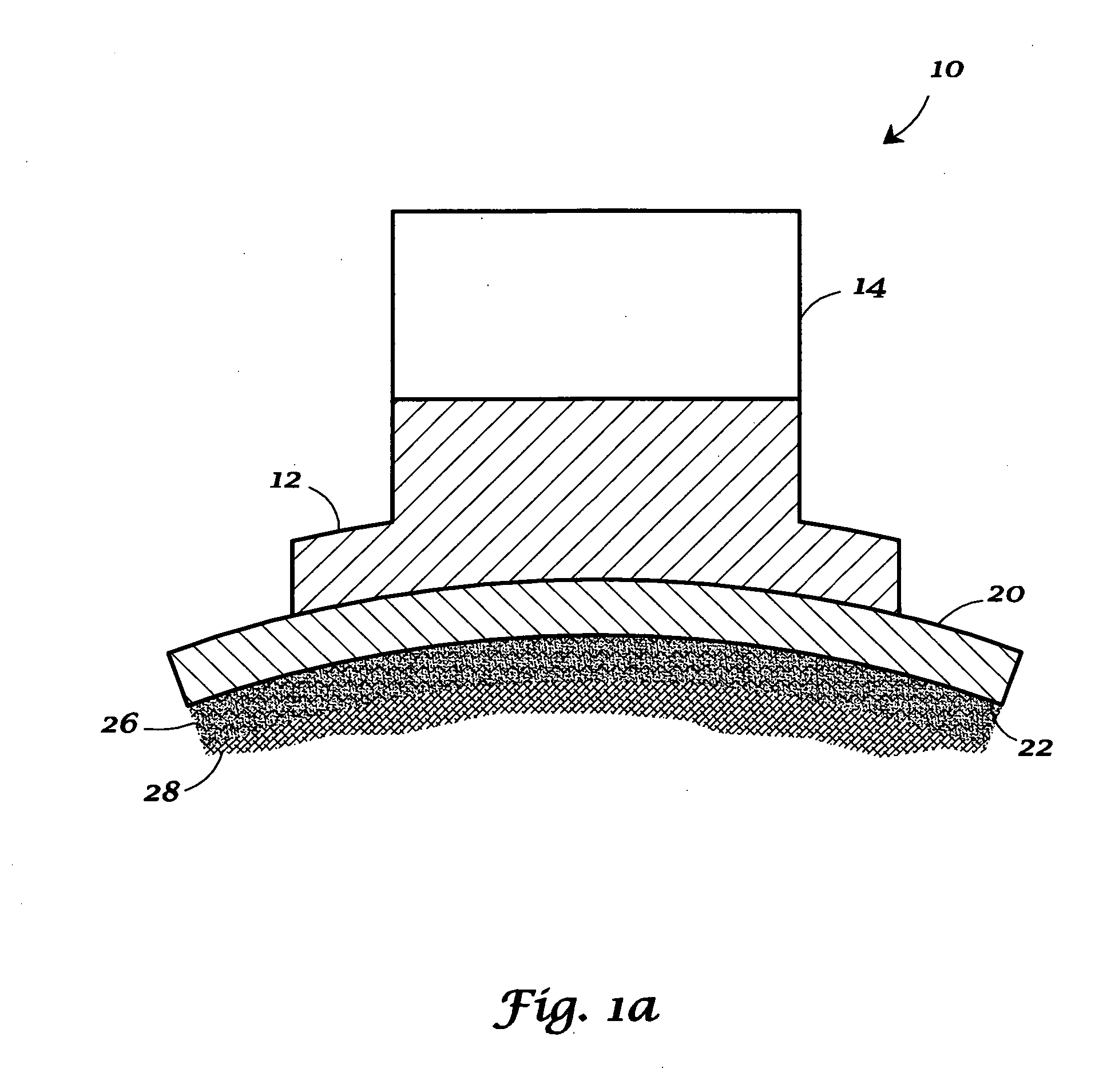 Methods for indirect bonding of orthodontic appliances