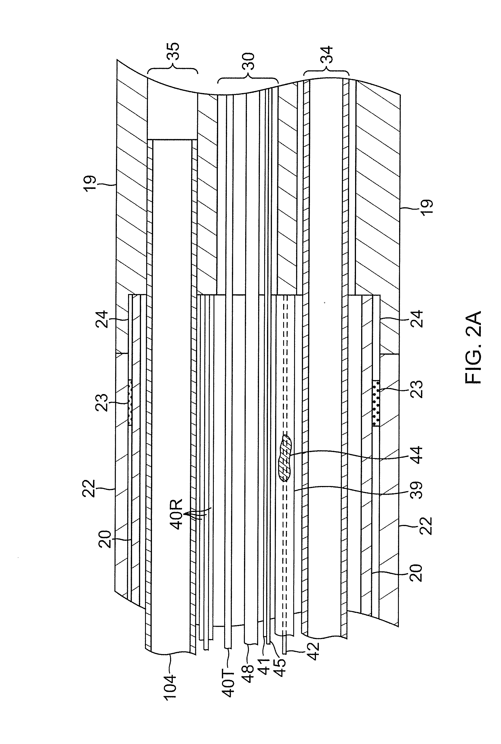 Irrigated catheter with fluid evacuation