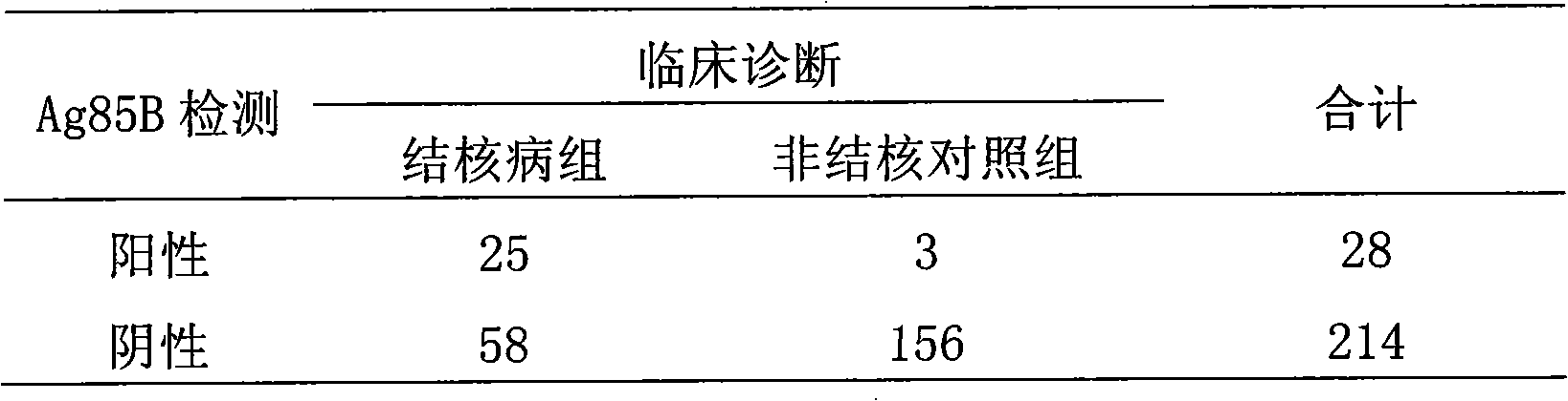 Oligonucleotides aptamer of targeted mycobacterium tuberculosis Ag85B, preparation method and application thereof