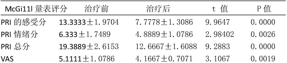 Pure traditional Chinese medicine drug for treating migraine and application method