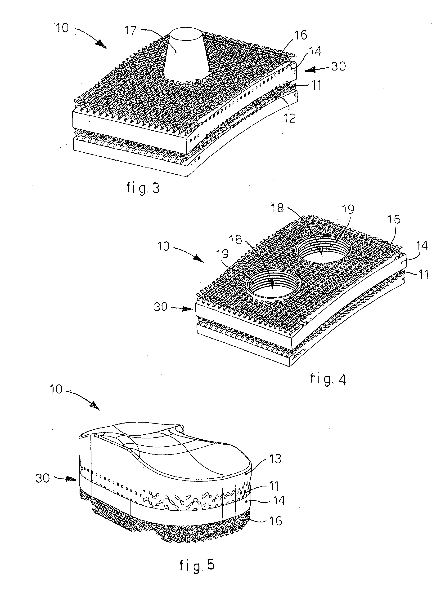 Integrated prosthetic element