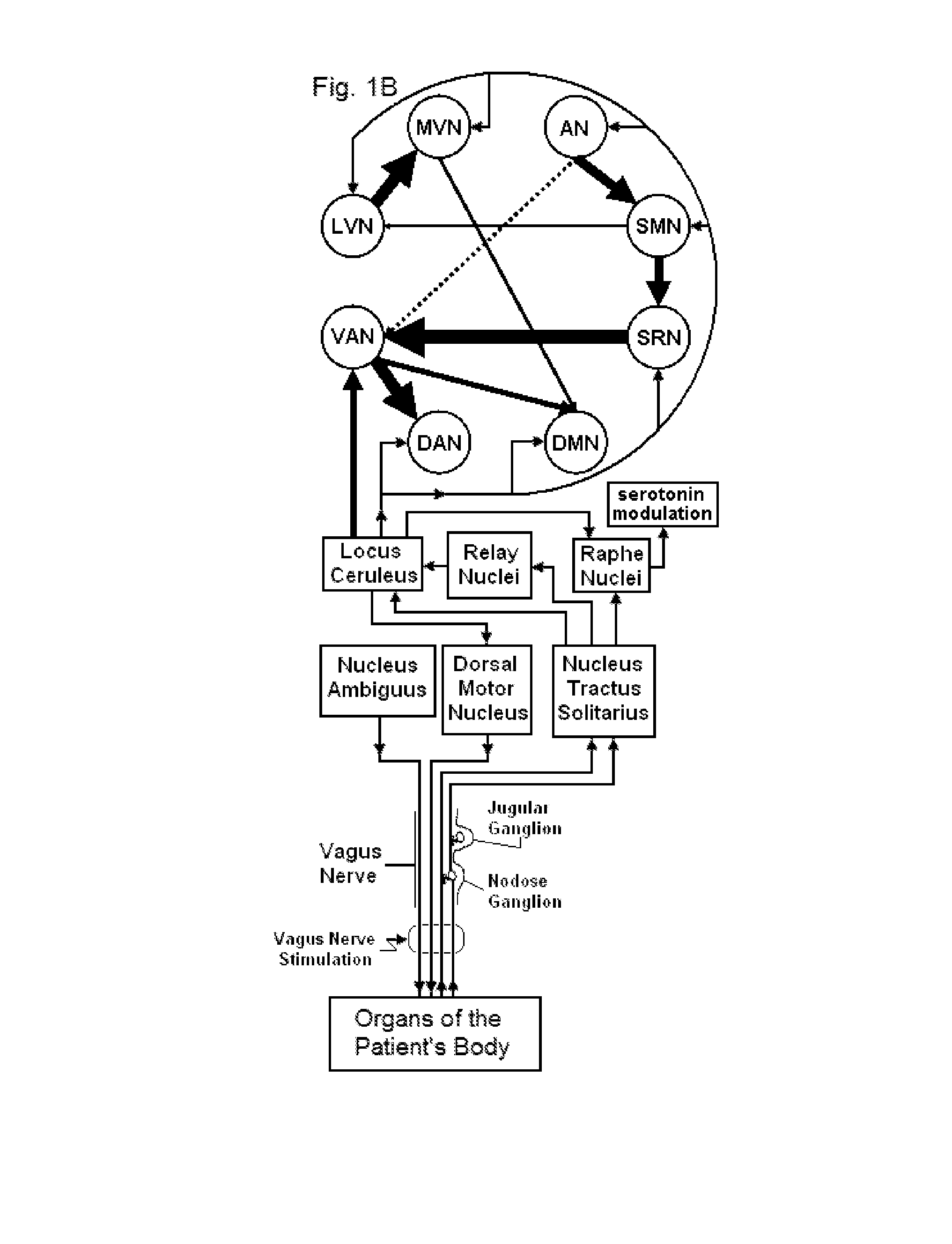 Mobile phone for treating a patient with seizures