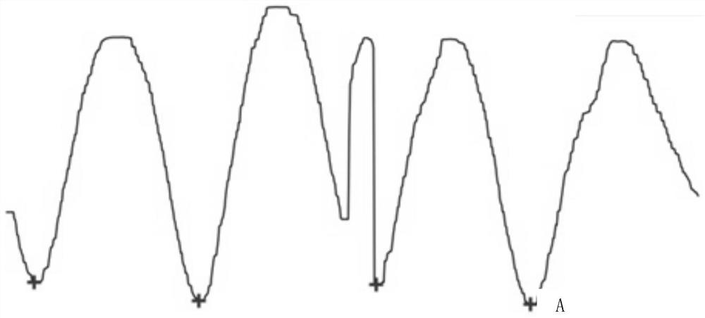 A running posture assessment method, device, equipment and storage medium