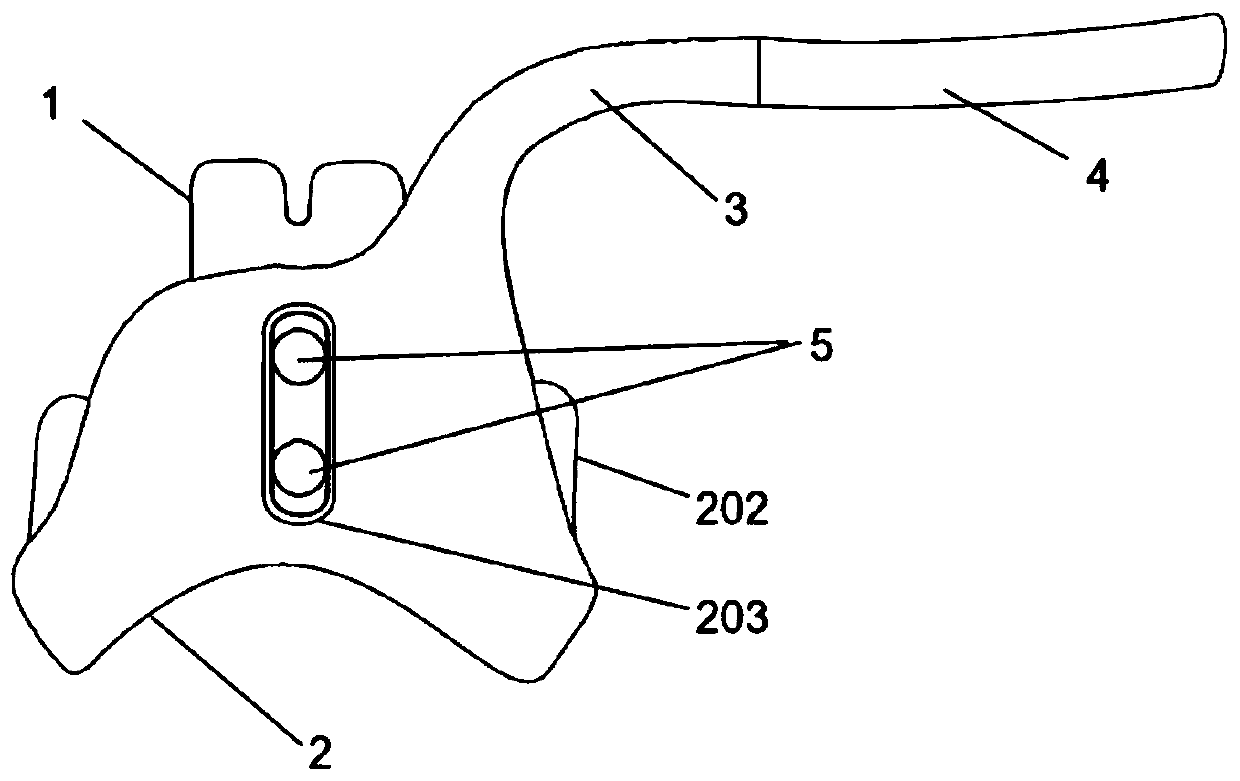 Sternoclavicular joint elastic inner fixing device