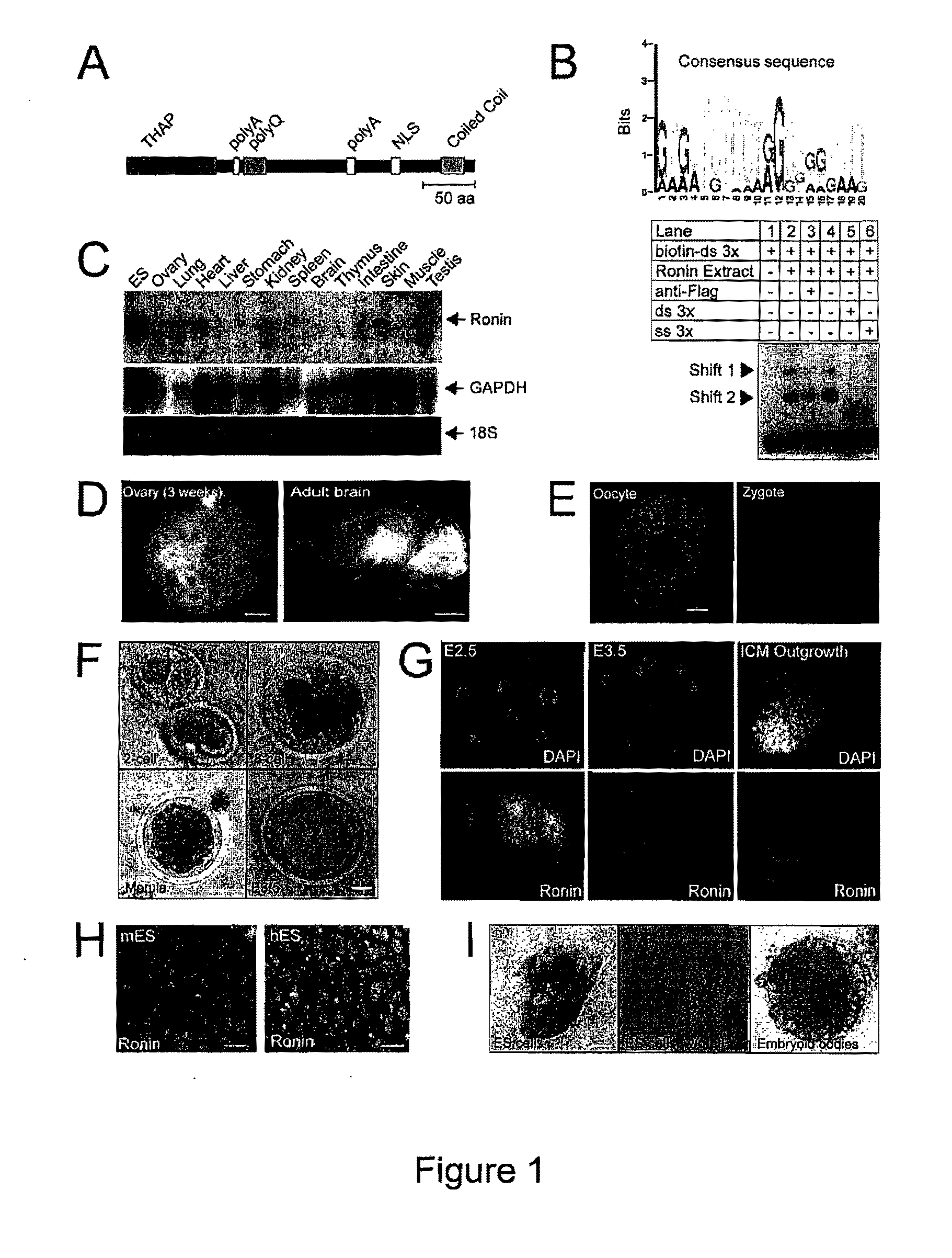 Ronin is Essential for Perpetuity of Mouse ES Cells, and Acts Independently of Canonical Pathways