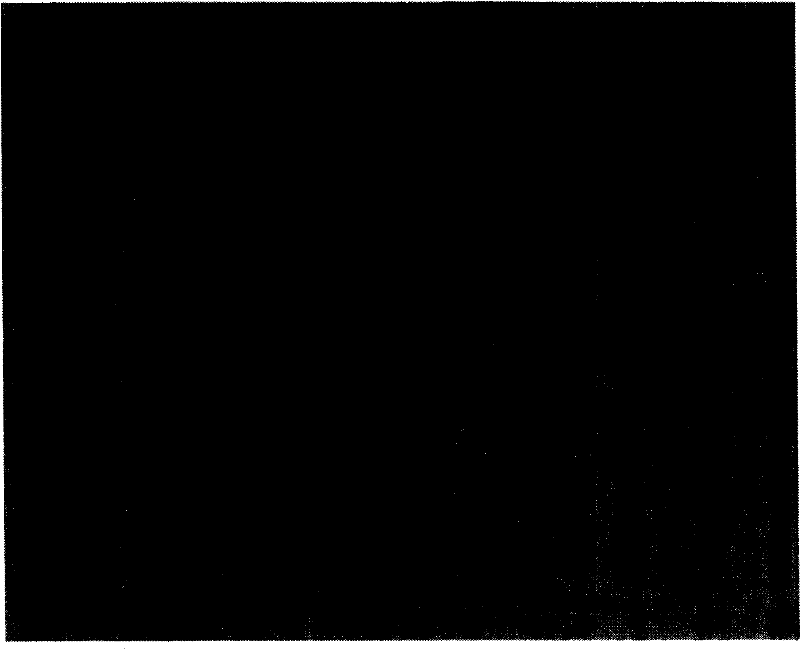 Anti-bladder cancer target superantigen and preparation method thereof