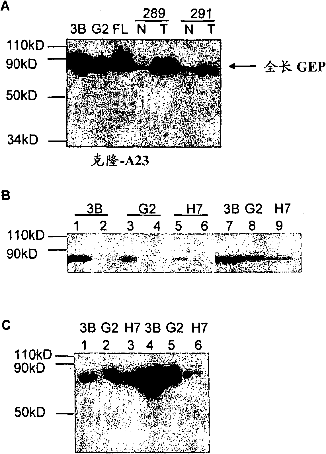 The use of granulin-epithelin precursor (GEP) antibodies for detection and suppression of hepatocellular carcinoma (HCC)