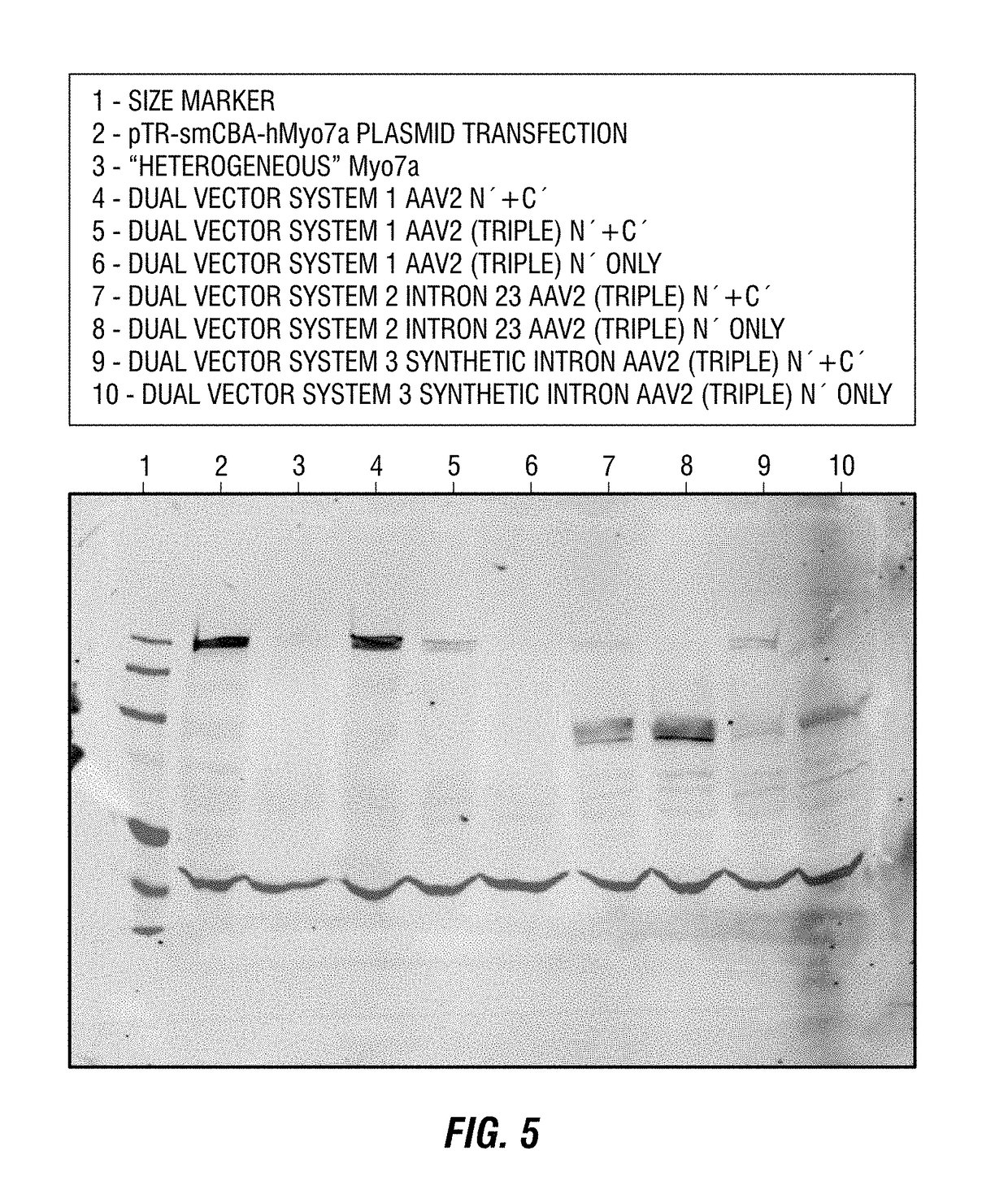 Dual-AAV vector-based systems and methods for delivering oversized genes to mammalian cells