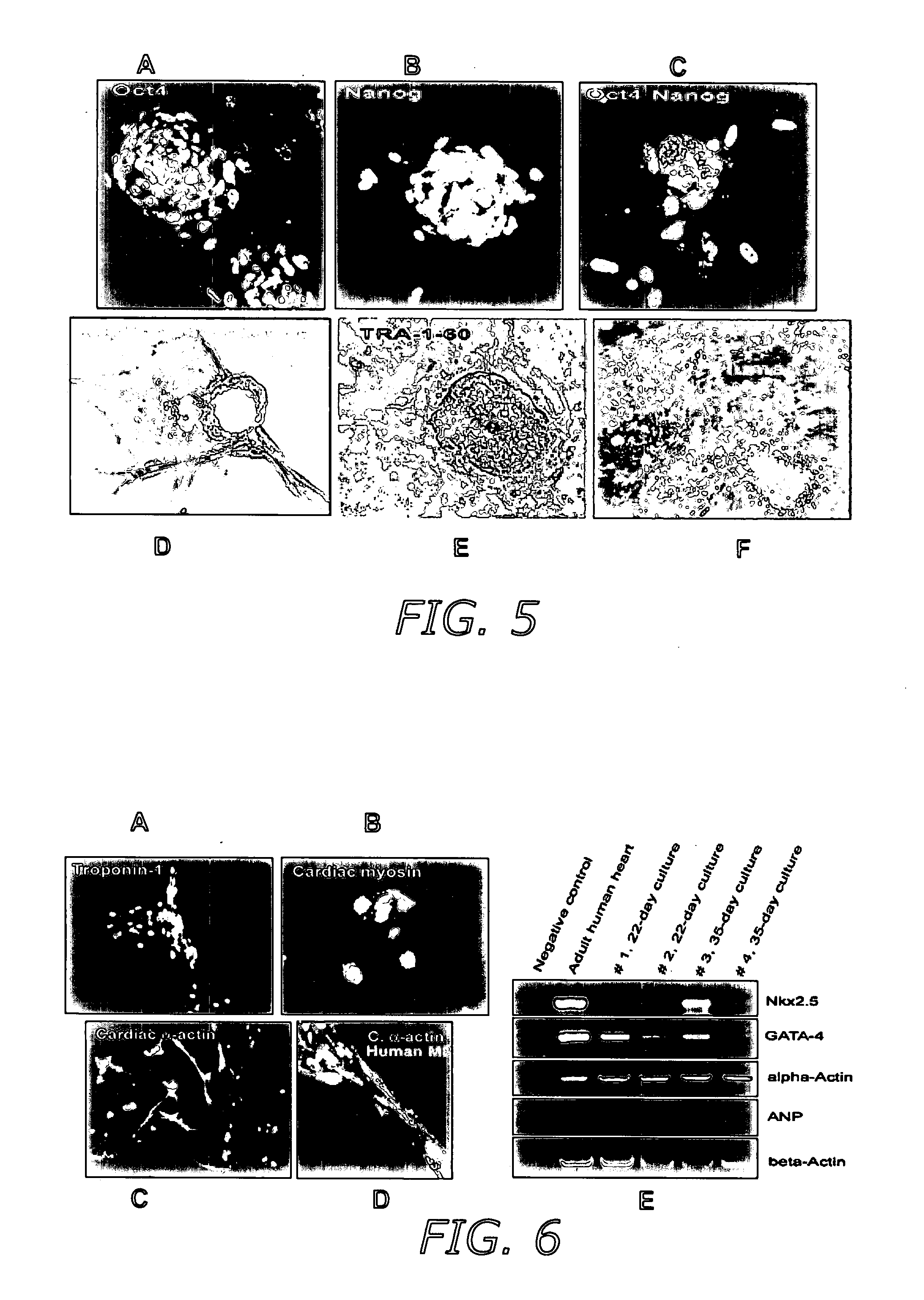 Reprogramming of adult human testicular stem cells to pluripotent germ-line stem cells