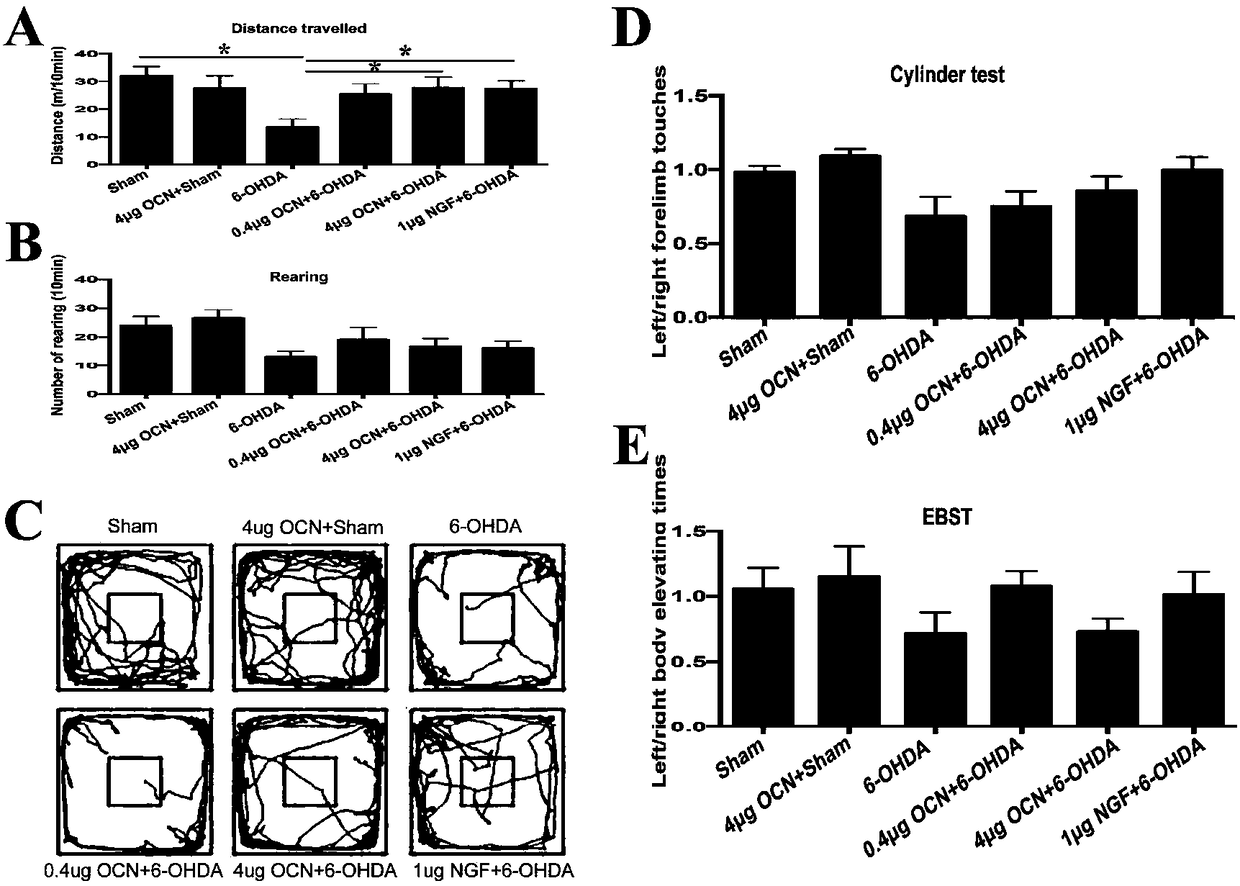 Use of osteocalcin for preparing medicine for treating Parkinson's diseases