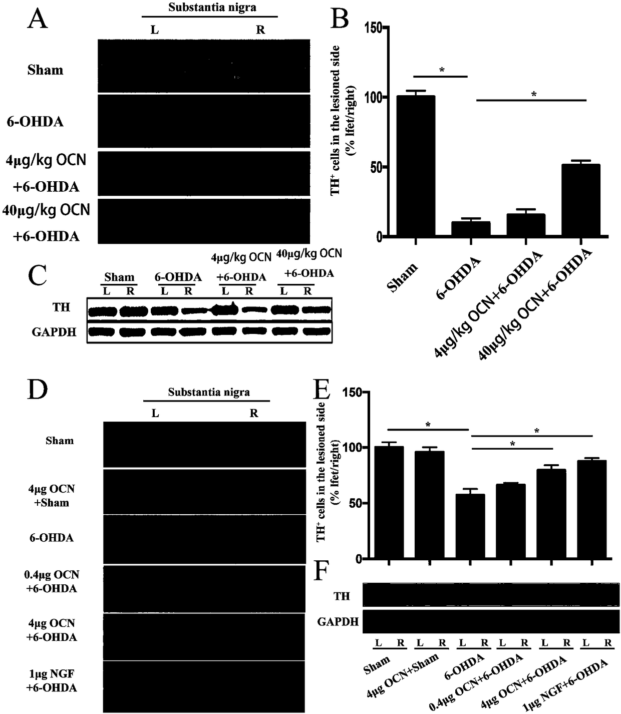 Use of osteocalcin for preparing medicine for treating Parkinson's diseases