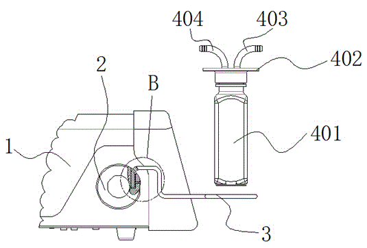 Ultrasonic negative-pressure in-vivo stone removing device