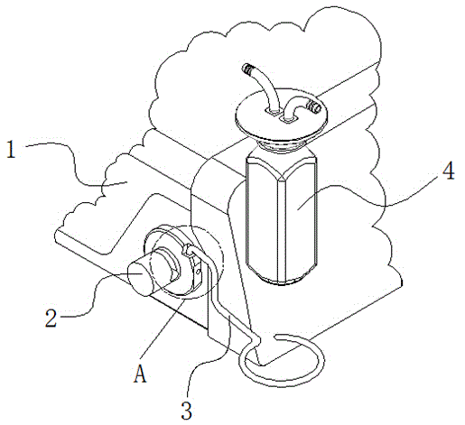 Ultrasonic negative-pressure in-vivo stone removing device