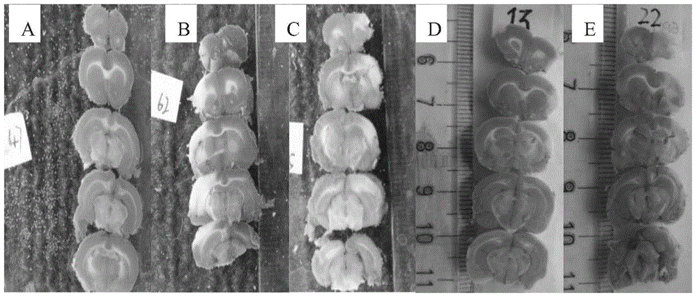 Flavonoid compound, preparation method and application thereof