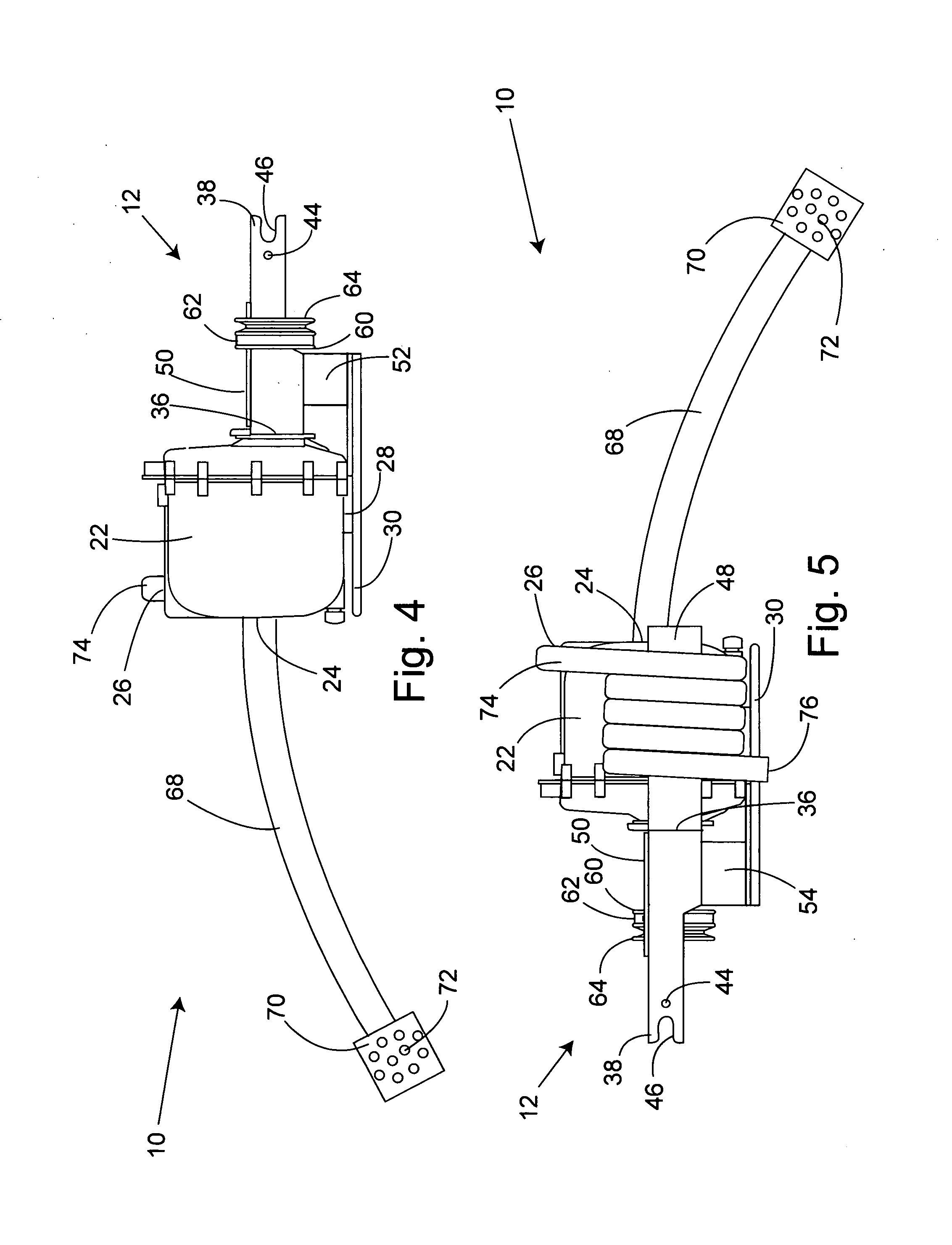 Front mounted pump