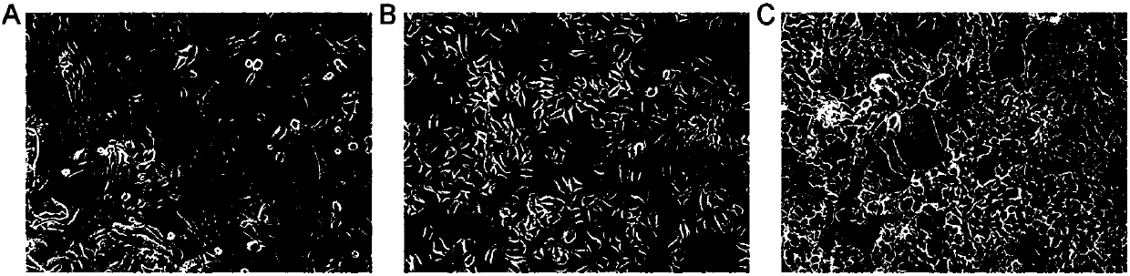 Human biliary tract cancer cell lines and application