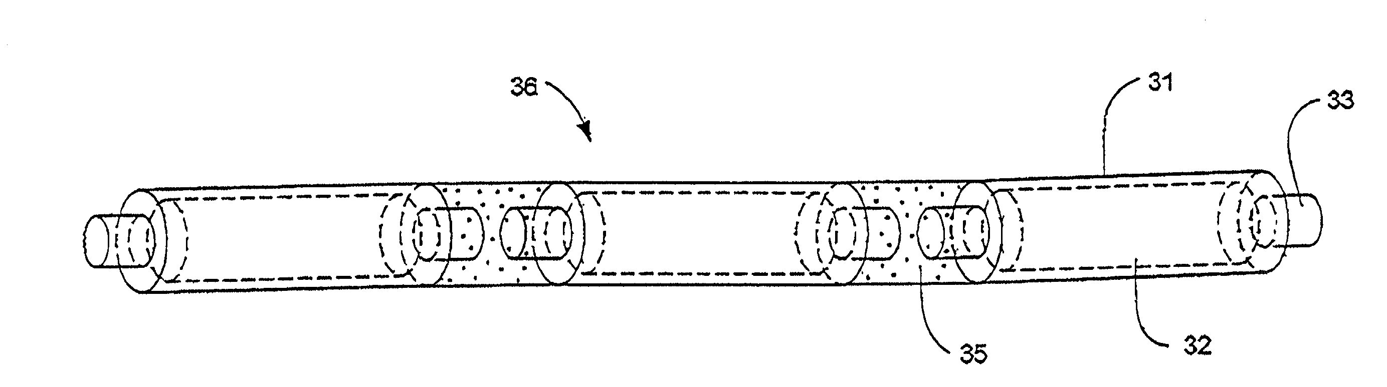 Delivery system and method for interstitial radiation therapy using seed elements with ends having one of projections and indentations