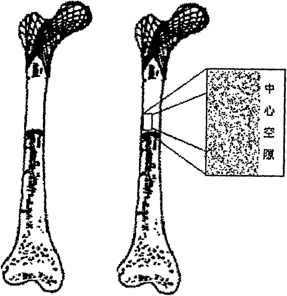 Method for preparing hollow fiber multiporous biological titanium material