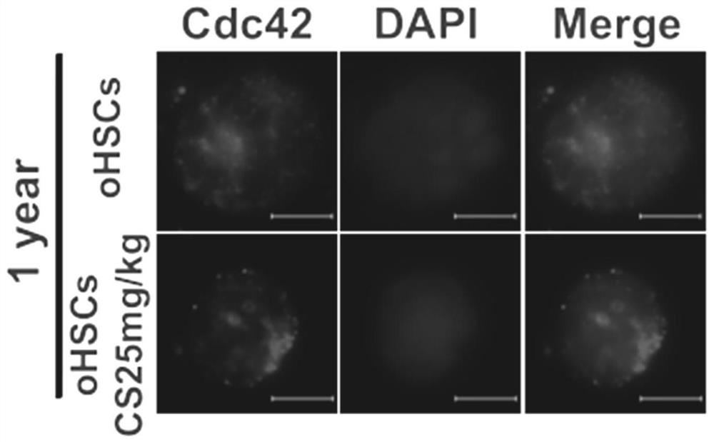 Application of RORa protein and agonist thereof in preparation of anti-aging drugs