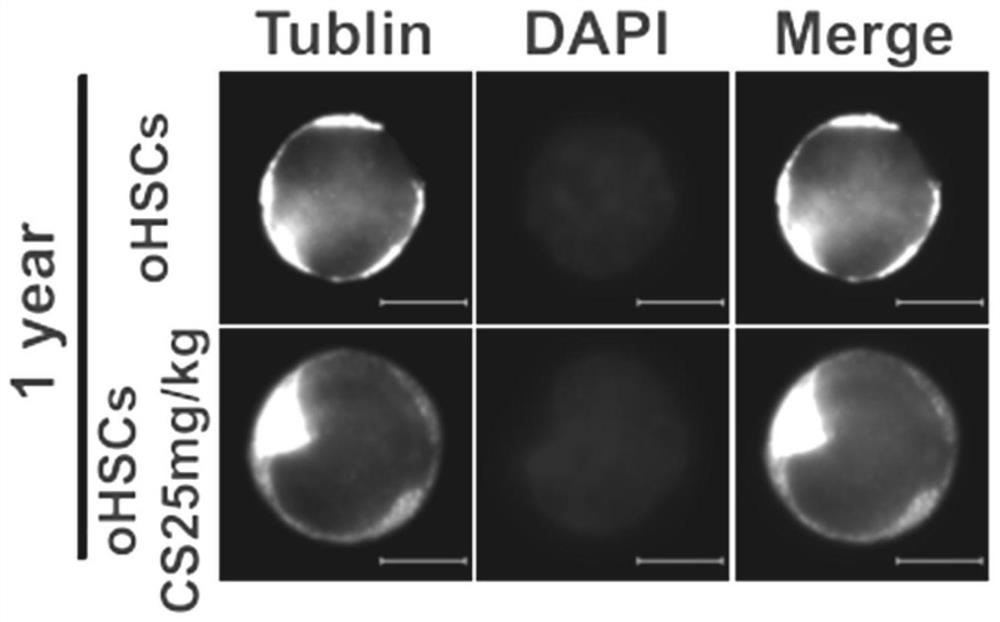 Application of RORa protein and agonist thereof in preparation of anti-aging drugs