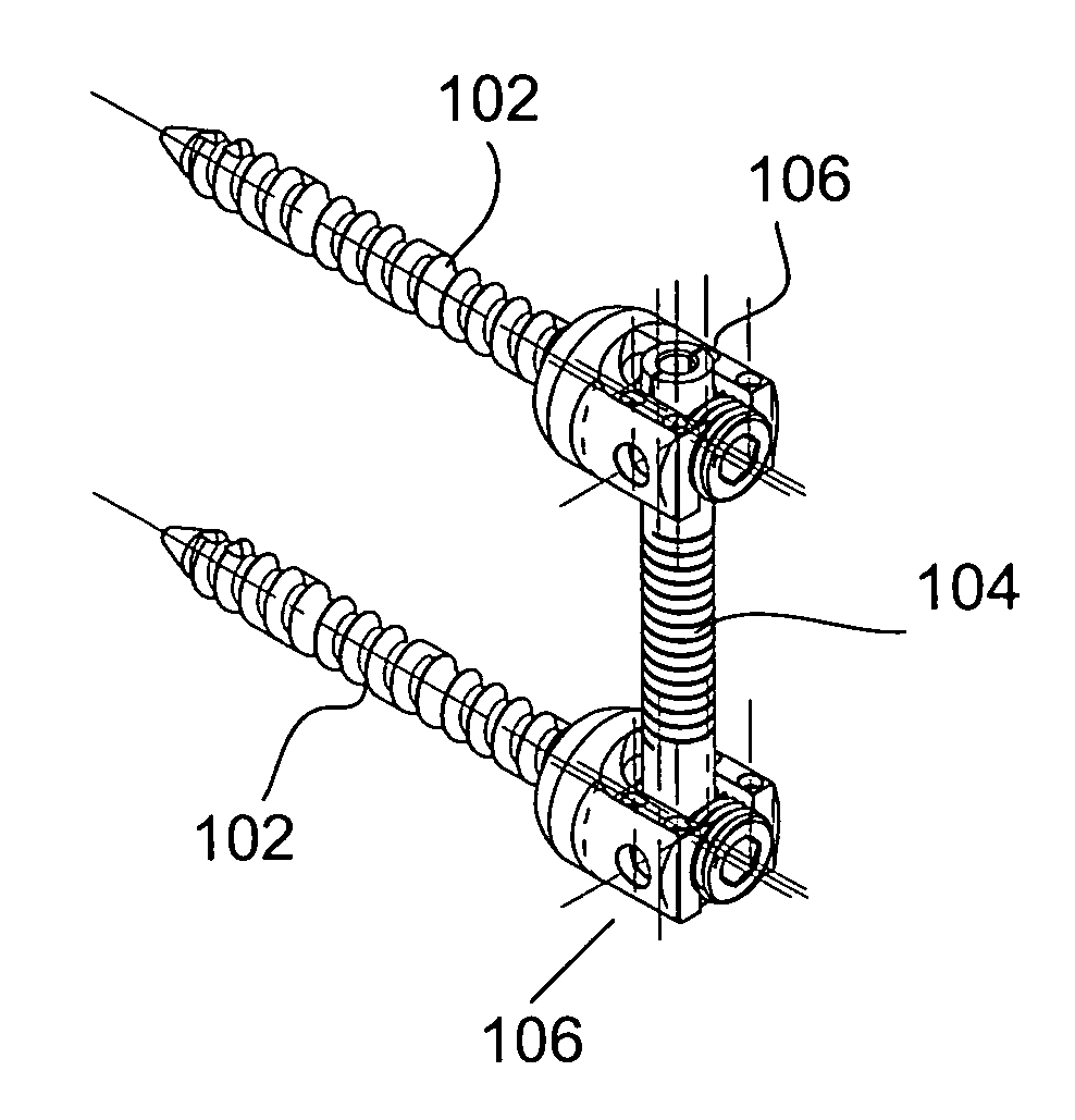 Vertebral stabilization using flexible rods