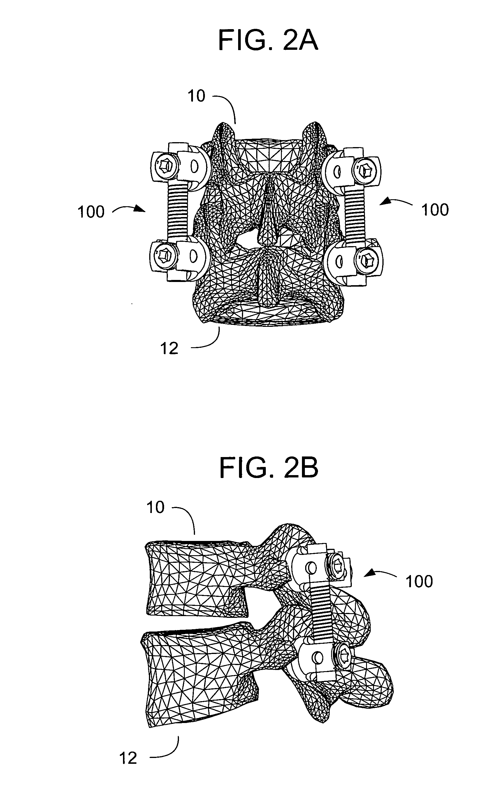 Vertebral stabilization using flexible rods