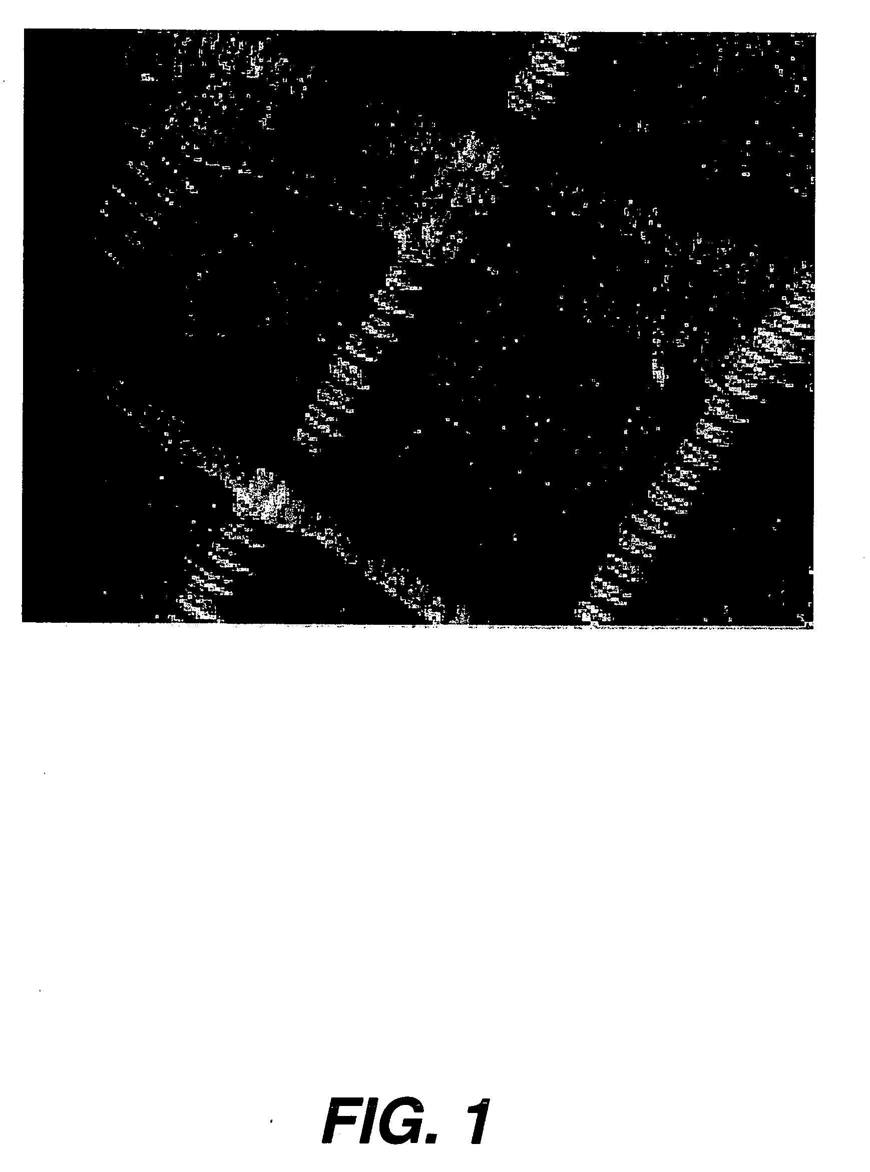 Method for stromal corneal repair and refractive alteration