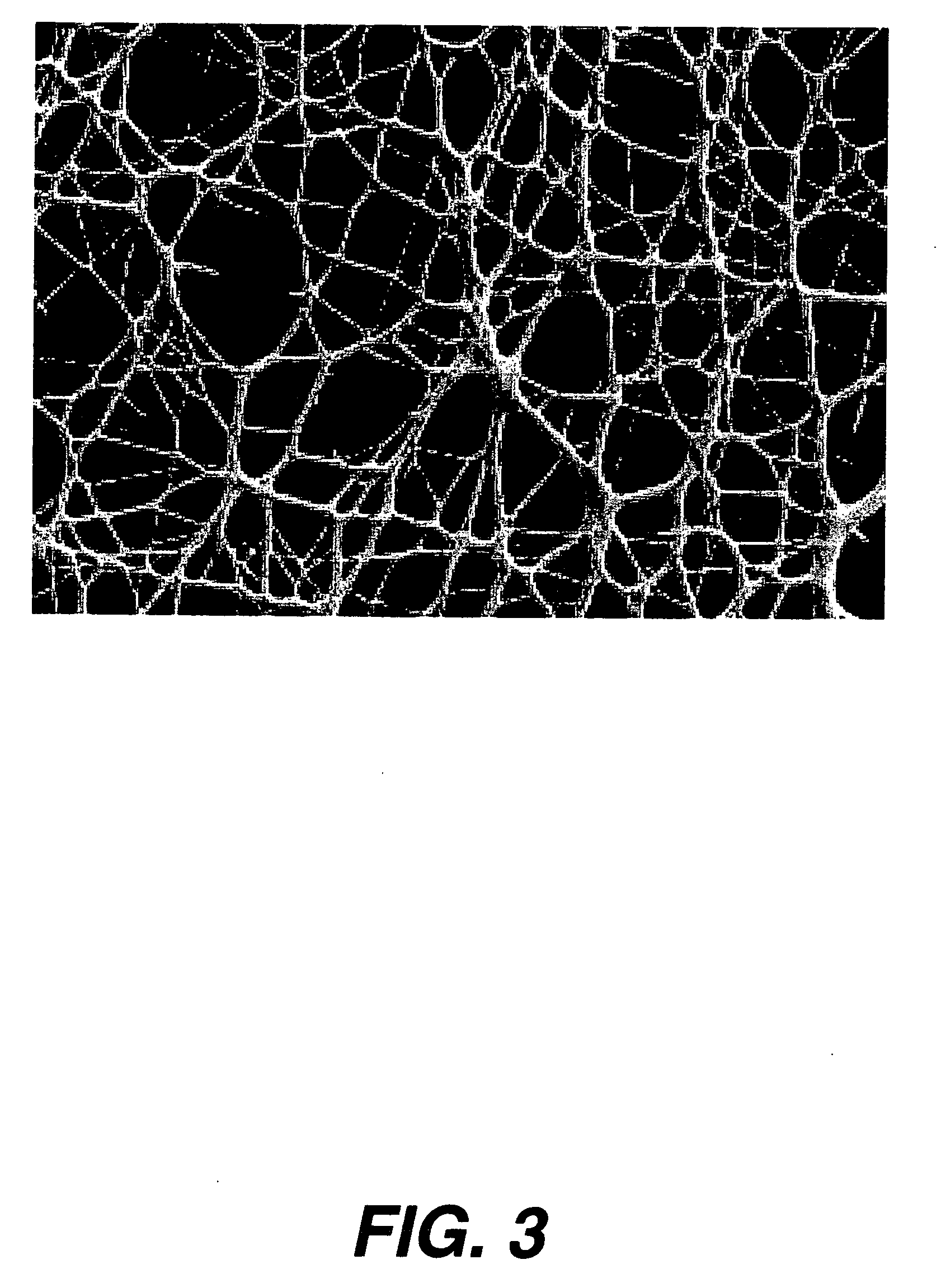 Method for stromal corneal repair and refractive alteration