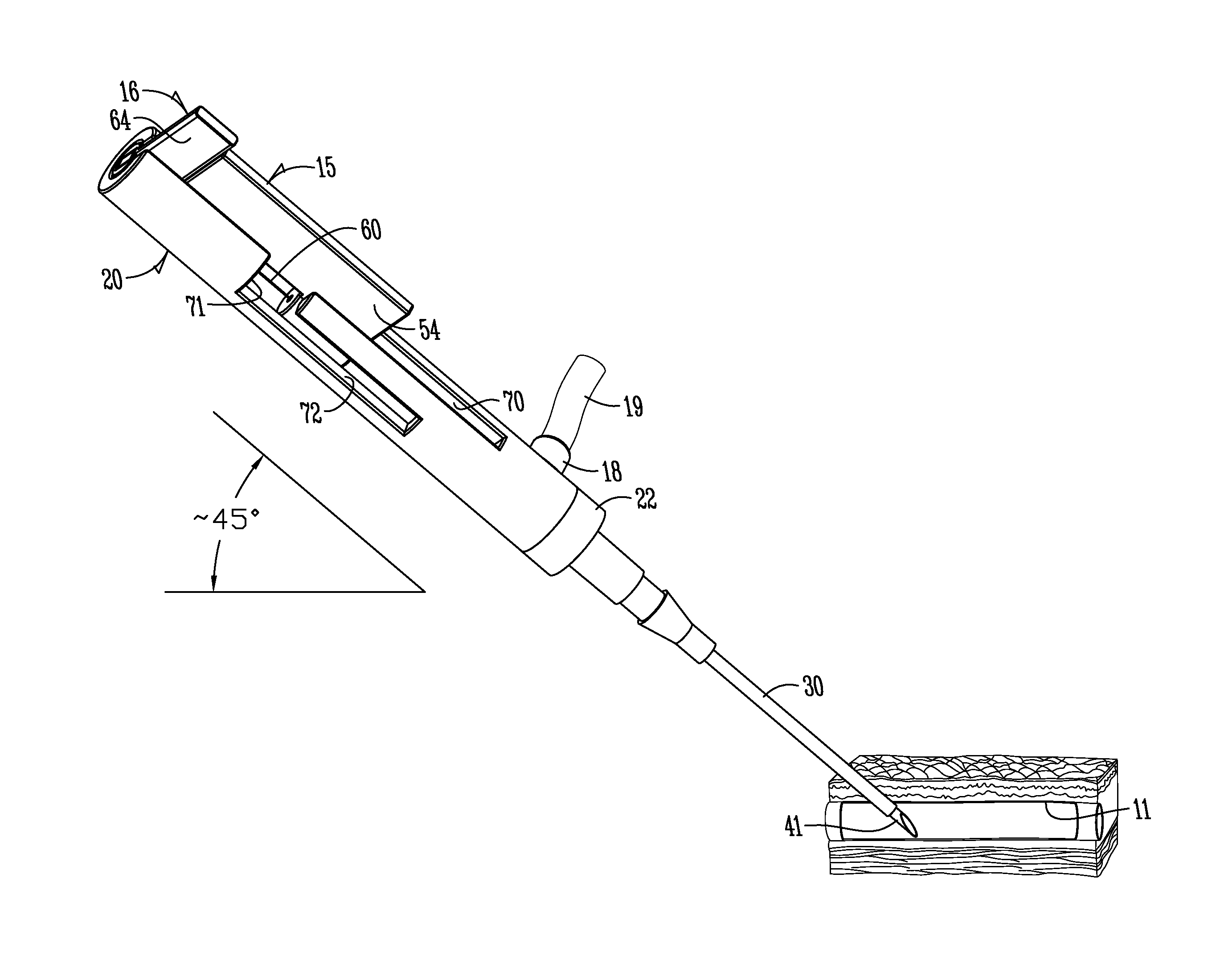 Catheter assembly with segmented stabilization system