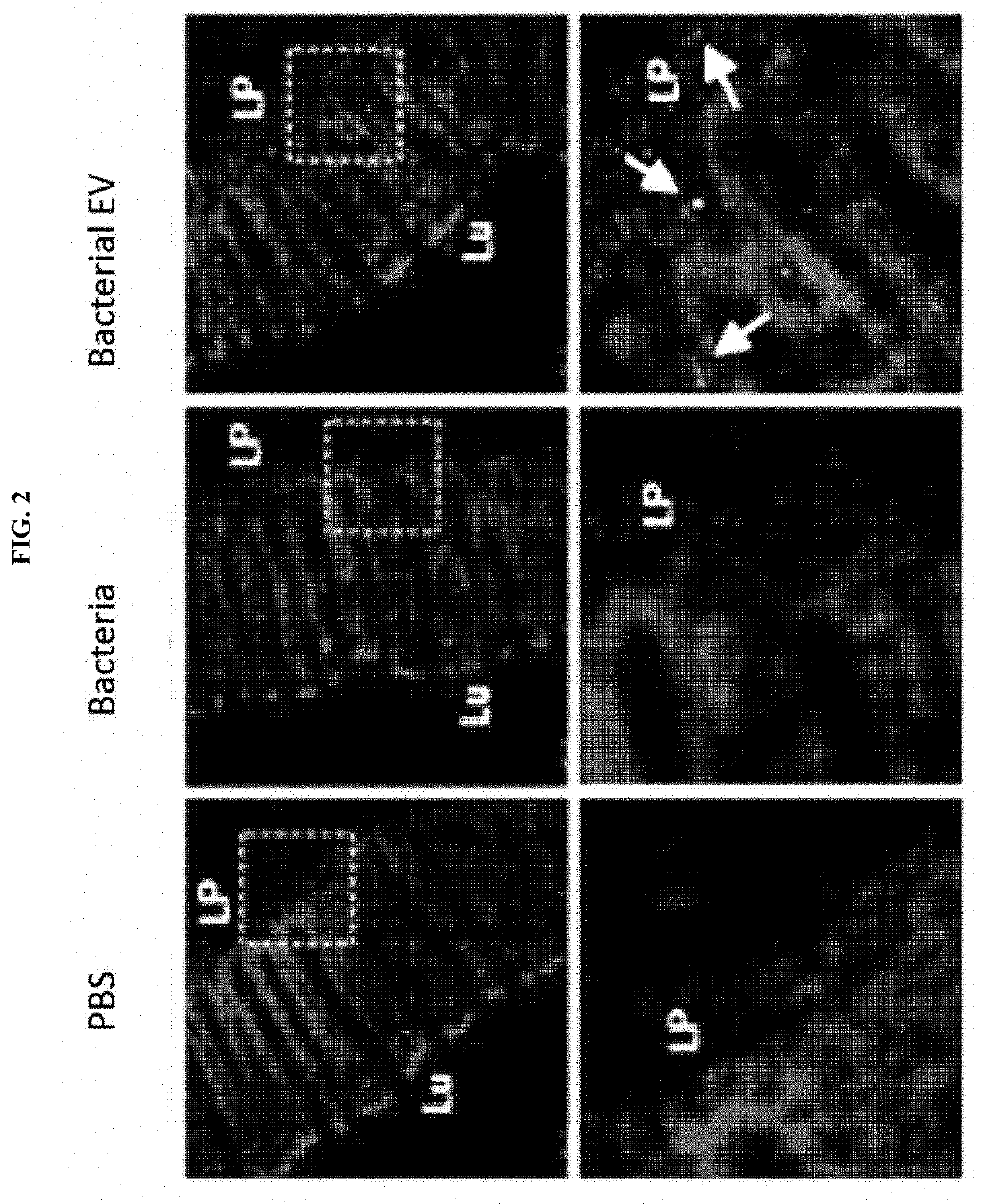 Nanovesicles derived from bacteria of genus deinococcus, and use thereof