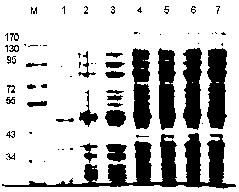 A diagnosis antigen for Toxoplasma gondii infection and a preparation method and applications thereof