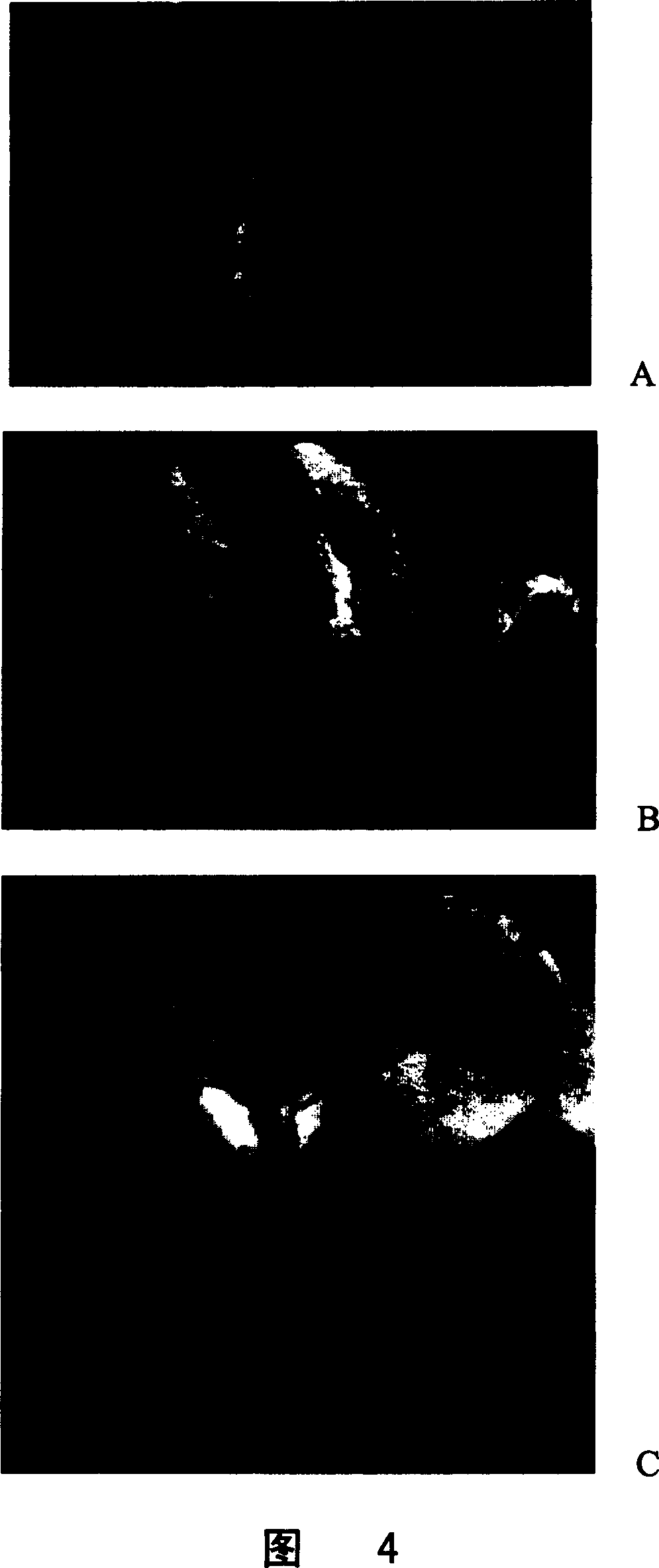 Cotton verticillium wilt germ secreted exciton gene and its application