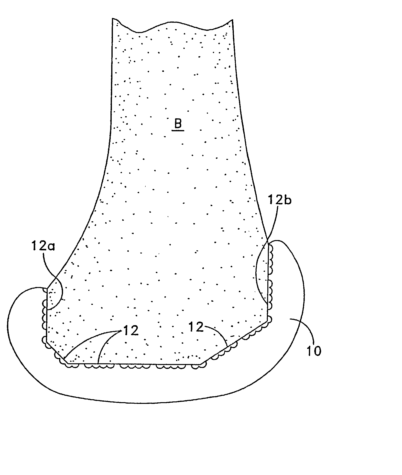 Textured surface having undercut micro recesses in a surface