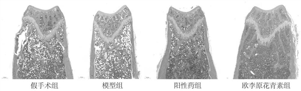 Prunus humilis procyanidine as well as preparation method, application and medicine thereof