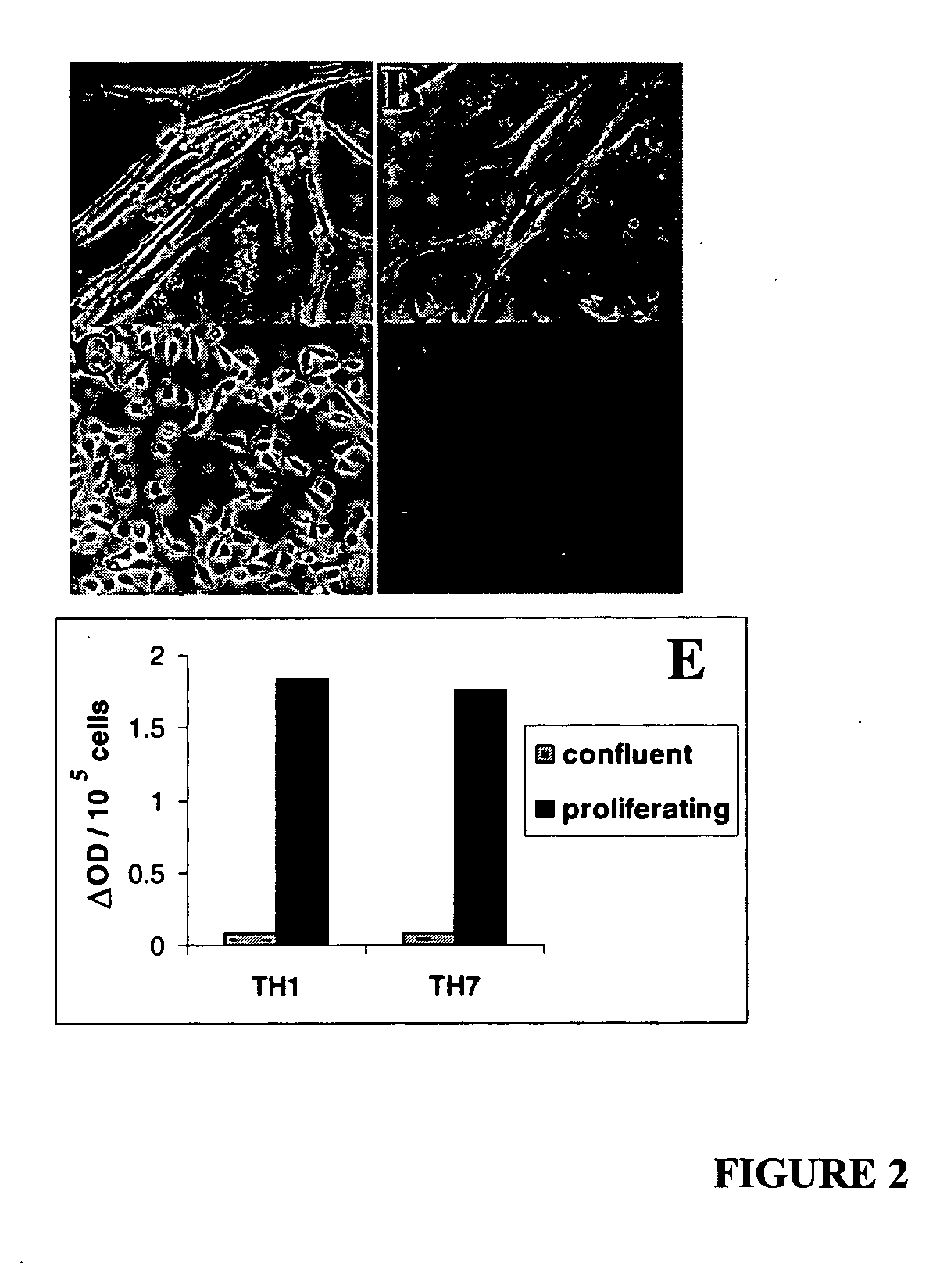 Reversible immortalization of human renal proximal tubular epithelial cells