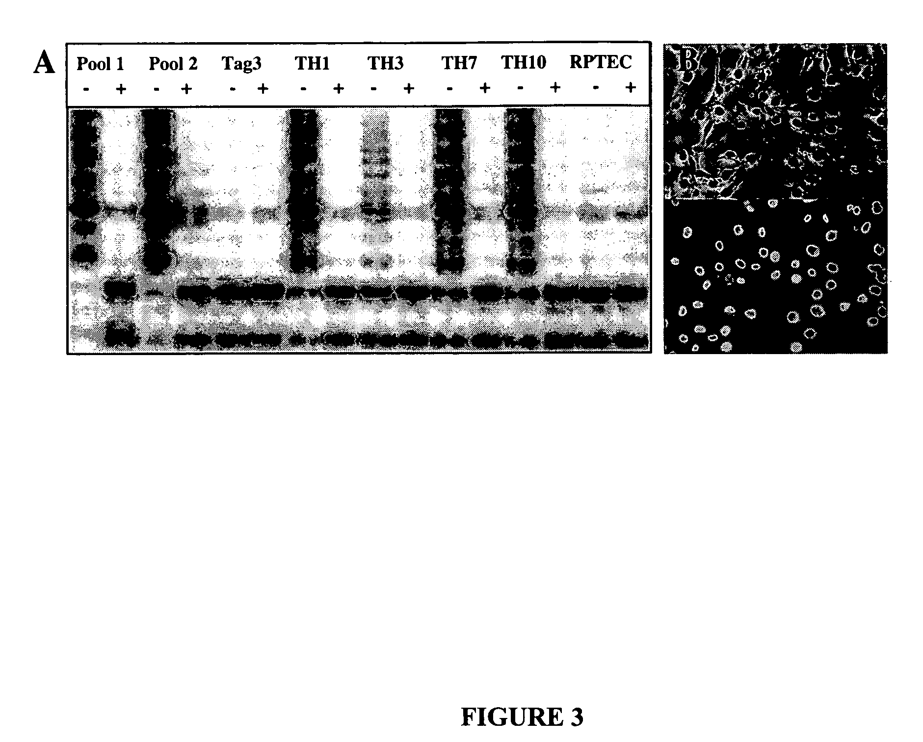 Reversible immortalization of human renal proximal tubular epithelial cells