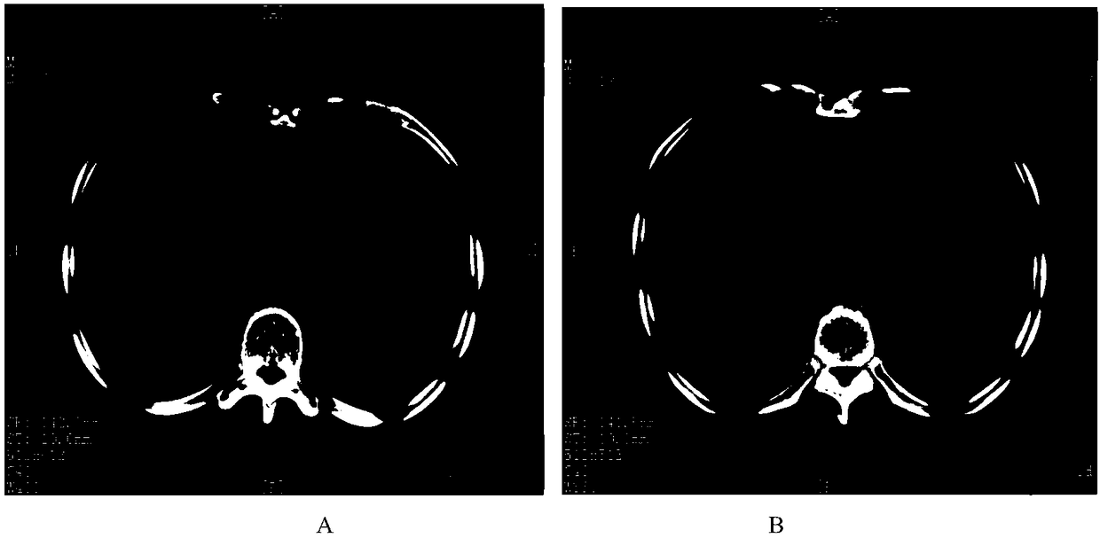 Antigenic peptide chain group for treating tumor and application of antigenic peptide chain group in medicine