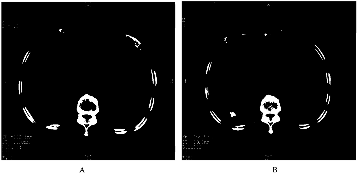 Antigenic peptide chain group for treating tumor and application of antigenic peptide chain group in medicine