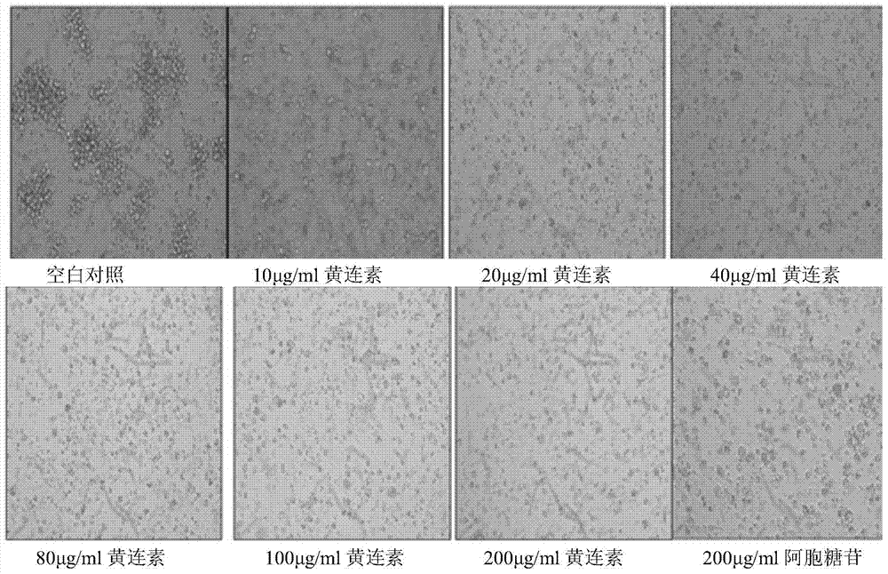 Application of berberine in preparation of medicine for treating acute myeloid leukemia